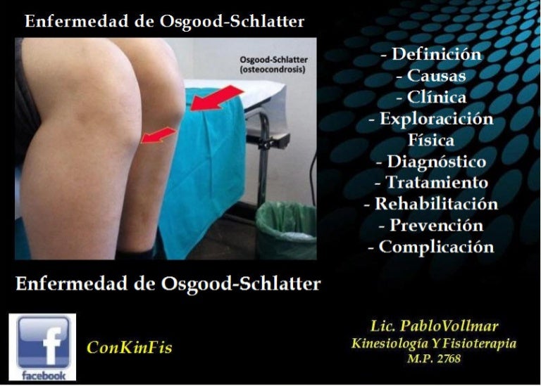 Enfermedad De Osgood Schlatter Pdf